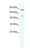 GIOT3 antibody, NBP1-80276, Novus Biologicals, Western Blot image 