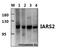 Isoleucyl-TRNA Synthetase 2, Mitochondrial antibody, A09580-1, Boster Biological Technology, Western Blot image 