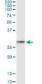 Exosome Component 3 antibody, H00051010-M11, Novus Biologicals, Immunoprecipitation image 