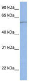 Solute Carrier Family 22 Member 11 antibody, TA333750, Origene, Western Blot image 