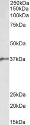 Bone Morphogenetic Protein Receptor Type 2 antibody, 43-553, ProSci, Western Blot image 