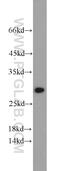 Acidic Nuclear Phosphoprotein 32 Family Member B antibody, 10843-1-AP, Proteintech Group, Western Blot image 