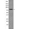 BR Serine/Threonine Kinase 2 antibody, PA5-64568, Invitrogen Antibodies, Western Blot image 