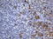 TNF Receptor Superfamily Member 8 antibody, LS-C797053, Lifespan Biosciences, Immunohistochemistry paraffin image 
