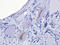 Arachidonate 15-Lipoxygenase Type B antibody, orb341186, Biorbyt, Immunohistochemistry paraffin image 