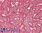 STEAP3 Metalloreductase antibody, LS-B12385, Lifespan Biosciences, Immunohistochemistry paraffin image 