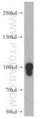 Dynamin-I antibody, 18205-1-AP, Proteintech Group, Western Blot image 