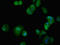 Integrin Subunit Alpha 5 antibody, orb400872, Biorbyt, Immunocytochemistry image 