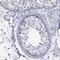 Glycogen Phosphorylase L antibody, NBP1-86182, Novus Biologicals, Immunohistochemistry paraffin image 