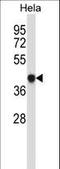 Glutamate Ionotropic Receptor NMDA Type Subunit Associated Protein 1 antibody, LS-C166682, Lifespan Biosciences, Western Blot image 