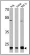 CD58 Molecule antibody, NBP2-22542, Novus Biologicals, Western Blot image 