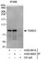 Tudor Domain Containing 3 antibody, A302-691A, Bethyl Labs, Immunoprecipitation image 