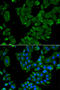 Drebrin 1 antibody, STJ28449, St John