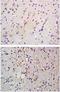 Eukaryotic Translation Initiation Factor 2 Alpha Kinase 2 antibody, orb6786, Biorbyt, Immunohistochemistry paraffin image 