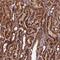 Coiled-Coil Domain Containing 8 antibody, NBP1-85085, Novus Biologicals, Immunohistochemistry frozen image 