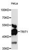 TRNA Isopentenyltransferase 1 antibody, LS-C748159, Lifespan Biosciences, Western Blot image 