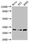 Proteasome Subunit Alpha 1 antibody, LS-C679225, Lifespan Biosciences, Western Blot image 