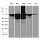Insulin Like Growth Factor 2 MRNA Binding Protein 3 antibody, M02362, Boster Biological Technology, Western Blot image 