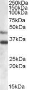 Arylsulfatase B antibody, EB08059, Everest Biotech, Western Blot image 