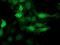 Cyclin Dependent Kinase 2 antibody, NBP2-00776, Novus Biologicals, Immunofluorescence image 