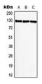 BMP2 Inducible Kinase antibody, MBS820321, MyBioSource, Western Blot image 