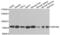 Zinc Finger Protein 408 antibody, PA5-76410, Invitrogen Antibodies, Western Blot image 