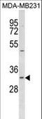 Fumarylacetoacetate Hydrolase Domain Containing 2A antibody, LS-C159589, Lifespan Biosciences, Western Blot image 