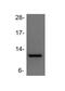 Trefoil Factor 1 antibody, NBP1-90813, Novus Biologicals, Western Blot image 