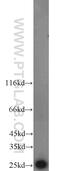 Transcription Factor A, Mitochondrial antibody, 22586-1-AP, Proteintech Group, Western Blot image 