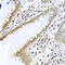 Transmembrane Protein 189 antibody, 23-544, ProSci, Immunohistochemistry paraffin image 