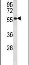 RAC-beta serine/threonine-protein kinase antibody, PA5-13761, Invitrogen Antibodies, Western Blot image 