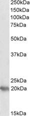 P53 Apoptosis Effector Related To PMP22 antibody, PA5-18510, Invitrogen Antibodies, Western Blot image 