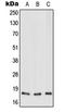 Mitochondrially Encoded NADH:Ubiquinone Oxidoreductase Core Subunit 3 antibody, LS-C353748, Lifespan Biosciences, Western Blot image 