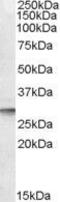 Dolichyl-Phosphate Mannosyltransferase Subunit 1, Catalytic antibody, GTX88562, GeneTex, Western Blot image 