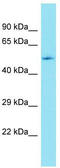 Ectonucleotide Pyrophosphatase/Phosphodiesterase 7 antibody, TA335354, Origene, Western Blot image 