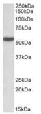 Lymphocyte-specific protein 1 antibody, AP23727PU-N, Origene, Western Blot image 