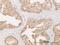 Dicarbonyl And L-Xylulose Reductase antibody, H00051181-M03, Novus Biologicals, Immunohistochemistry frozen image 