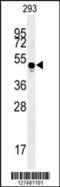 Myosin Light Chain Kinase Family Member 4 antibody, 62-122, ProSci, Western Blot image 