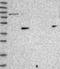 Alanine--Glyoxylate Aminotransferase 2 antibody, NBP1-89199, Novus Biologicals, Western Blot image 