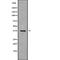 Nei Like DNA Glycosylase 2 antibody, abx217106, Abbexa, Western Blot image 