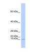 TAL BHLH Transcription Factor 2 antibody, NBP1-80307, Novus Biologicals, Western Blot image 