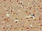 ALX Homeobox 1 antibody, LS-C677120, Lifespan Biosciences, Immunohistochemistry paraffin image 