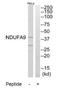 NADH:Ubiquinone Oxidoreductase Subunit A9 antibody, TA314237, Origene, Western Blot image 