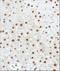 GLI Family Zinc Finger 3 antibody, NBP2-29627, Novus Biologicals, Immunohistochemistry frozen image 