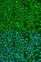 BRCA1 DNA Repair Associated antibody, STJ22043, St John