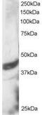 Death Associated Protein 3 antibody, PA5-18042, Invitrogen Antibodies, Western Blot image 