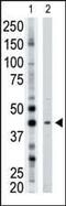 ADP-Ribosyltransferase 3 antibody, PA5-12122, Invitrogen Antibodies, Western Blot image 