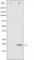 Eukaryotic Translation Initiation Factor 4E Binding Protein 1 antibody, abx010309, Abbexa, Western Blot image 