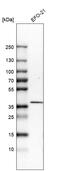 Transmembrane Protein 173 antibody, HPA038116, Atlas Antibodies, Western Blot image 