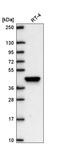 LHX8 antibody, HPA071806, Atlas Antibodies, Western Blot image 